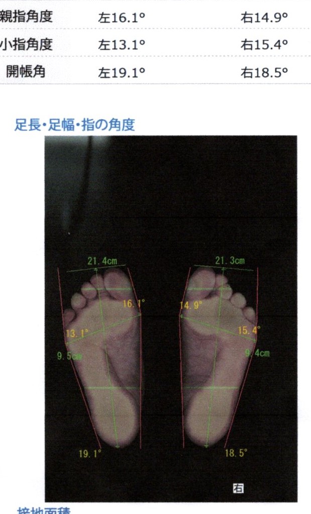 before画像