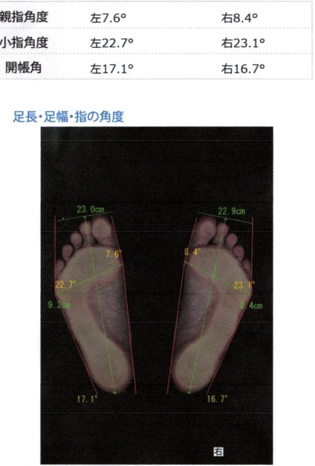 before画像