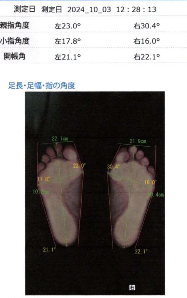 before画像